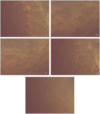 Potent Antibacterial and Antibiofilm Activities of a Synthetic Remineralizing Preparation of Nano-Hydroxyapatite Against Cariogenic Streptococcus mutans Using an Ex-vivo Animal Model